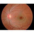 Cámara Oftalmológica Fundus Médica 650A